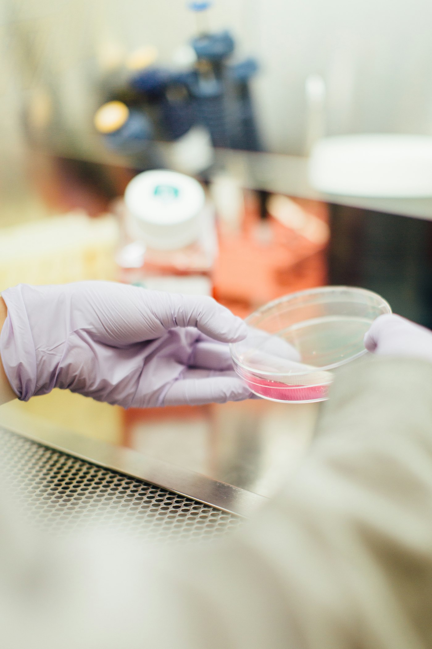 A gloved hand holding a petri dish in a clinical laboratory